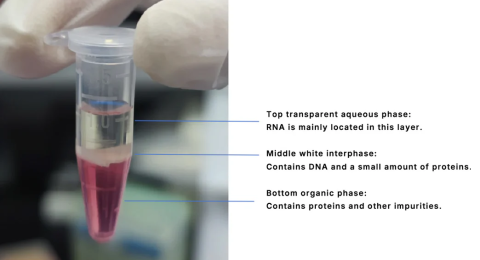 استخراج RNA تریزول فنل کلروفروم